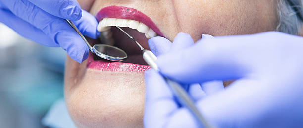 Best Emergency Dentist for Knocked-Out Tooth in Newburgh Heights, OH