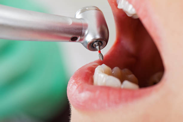 Best Pediatric Emergency Dentist in Newburgh Heights, OH